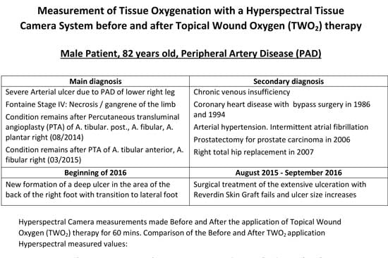 Measurement of Tissue Oxygenations with Hyperspectral Tissue before and after Topical Wound Oxygen Therapy