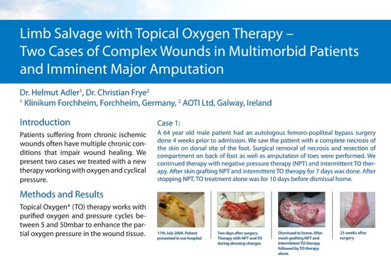 Clinical Evidence 12 Limb Salvage with Topical Wound Oxygen (TWO2) – Two Cases of Complex Wounds in Multimorbid Patients and Imminent Major Amputation