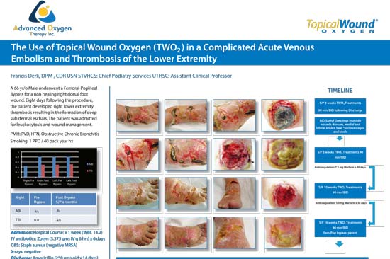 The Use of Topical Wound Oxygen (TWO2) in Complicated Acute Venous Embolism and Thrombosis of the Lower Extremity