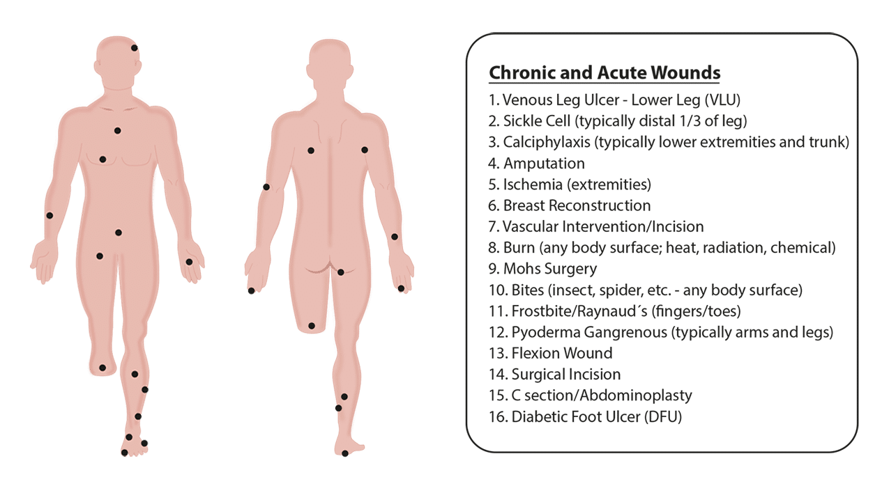 01 Chronic and acute wounds1 Final