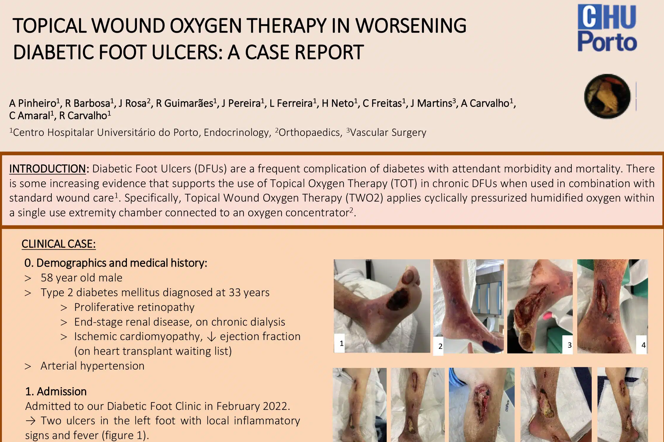 Clinical Evidence 11 Topical Wound Oxygen Therapy in Worsening Diabetic Foot Ulcers: A Case Report