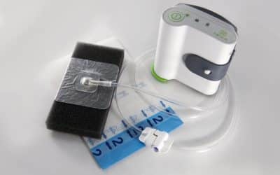 AOTI announces US FDA 510(k) Clearance of NEXA NPWT System for use in the home care setting